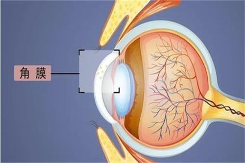 人工角膜移植：领扣型、米赫型与波士顿型优缺点大揭秘！
