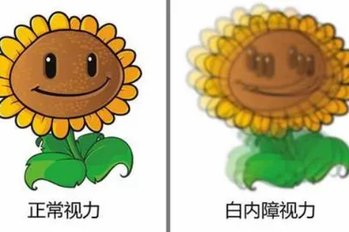 白内障免费治疗政策的定点医院有哪些?附申请流程和要求