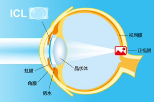 QQ截图20231220085743_副本