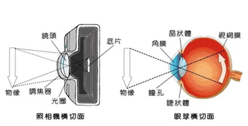 近视眼5.jpg