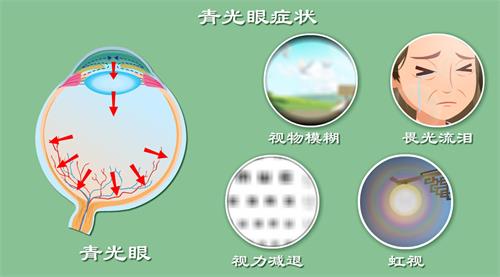青光眼的症状示意图