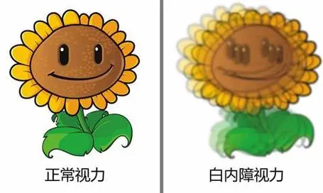 白内障的视力和正常眼睛视力的对比