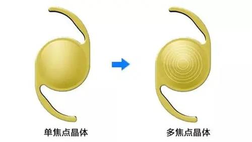 单焦点晶体和多焦点晶体示意图