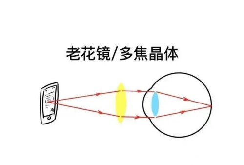 老花镜多焦晶体 示意图