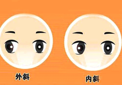 【儿童眼病解答】斜视手术后多久能恢复正常眼位?