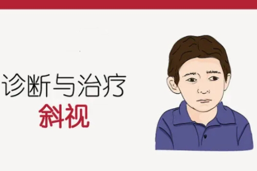 斜视的诊断与治疗
