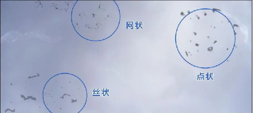 飞蚊症症状示意图