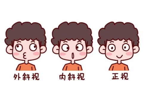 眼睛斜视有哪些症状和表现?治疗斜视的具体价格是多少?