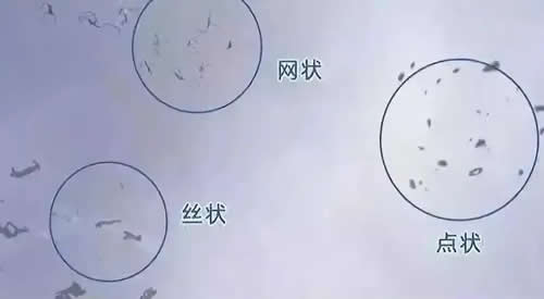 飞蚊症视觉展示