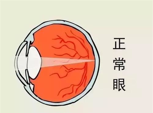 正常眼眼球示意图