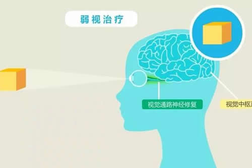 眼睛弱视能治好吗,分享弱视眼睛治疗方法和收费明细!