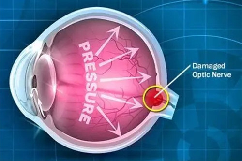 爱尔眼科好还是公办眼科好?文中教你如何更好选择眼科