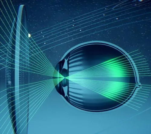 依视路星趣控离焦镜片防蓝光