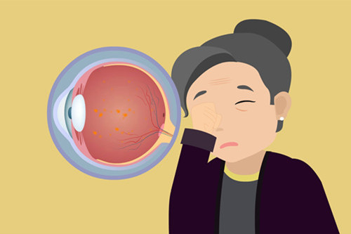飞蚊症卡通示意图