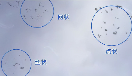 有人知道眼睛看东西有黑影飘动是怎么回事吗?小编整理了可能的原因一文奉上