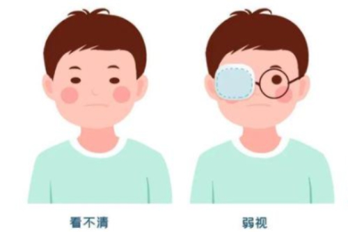 什么是弱视
