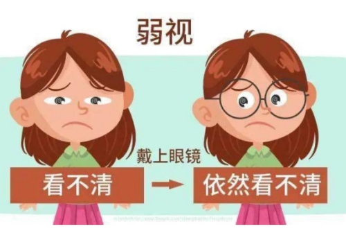 弱视眼的症状