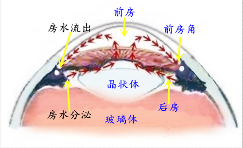 青光眼的形成原因