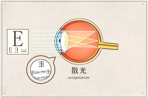 散光的示意图