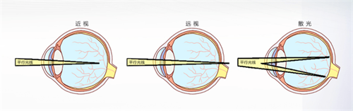 散光的视线范围