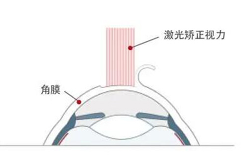 眼科医院在线问诊免费:正规团队24小时回复解答!