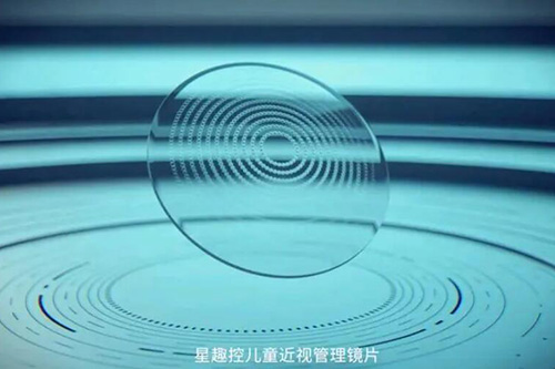 星趣控是法国品牌!改善如何?将原理+适合近视度数+价格一并分析!