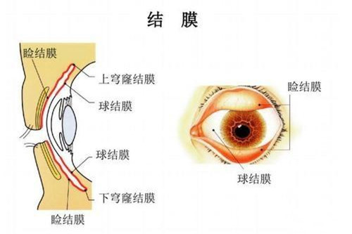 干货分享:青光眼的三个特征是什么?眼压升高|视野损失|视神经受损哪一个都很难受!