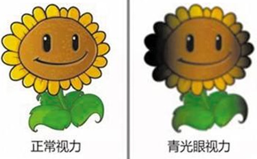 青光眼以及正常眼成像示意图