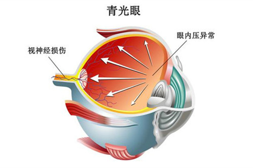 眼球分解图