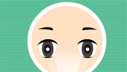 斜视卡通图