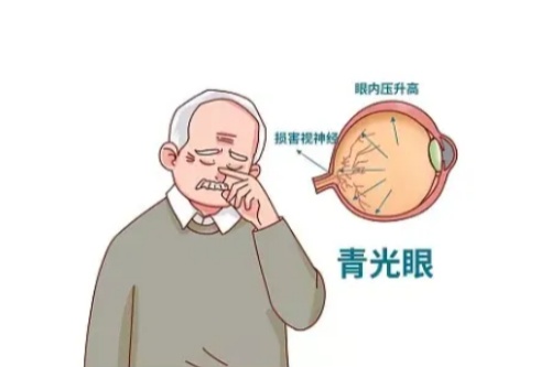 晶状体青光眼斑是怎么回事?怎么办?