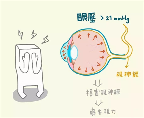【科普】青光眼患者能否通过换晶体手术治疗好？更换晶体后结果能维持多久？