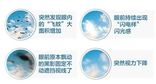 怎么区分飞蚊症和视网膜裂孔？本文将从发病原因、症状表现、治疗方法等多个方面解析下！