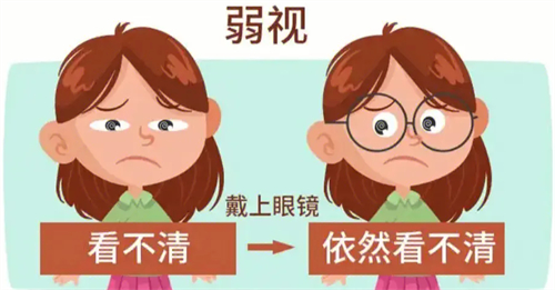 成年人眼睛弱视能做矫正手术吗？详细治疗方式以及主要事项一定要悉知！
