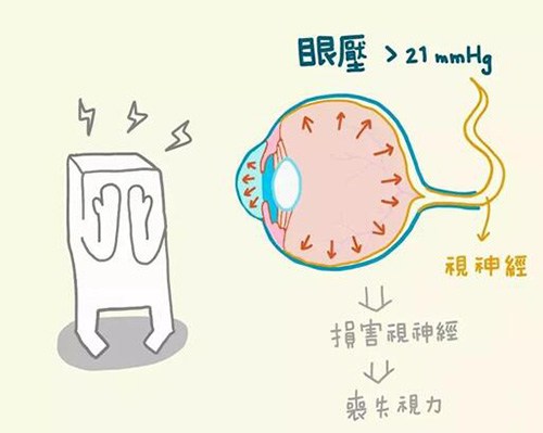 深圳做青光眼价格多少钱?2500-15000不等!不同改善方式价格有区别!